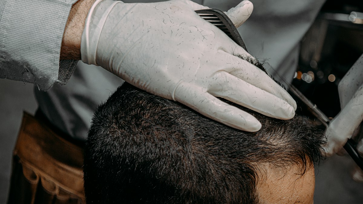 I capelli trapiantati possono cadere? Ecco quando